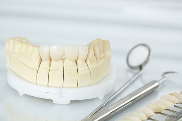 Có nên bọc răng sứ không cho răng hô không?