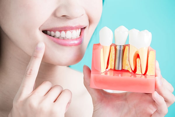 Tình trạng răng miệng và chất lượng xương hàm của bệnh nhân