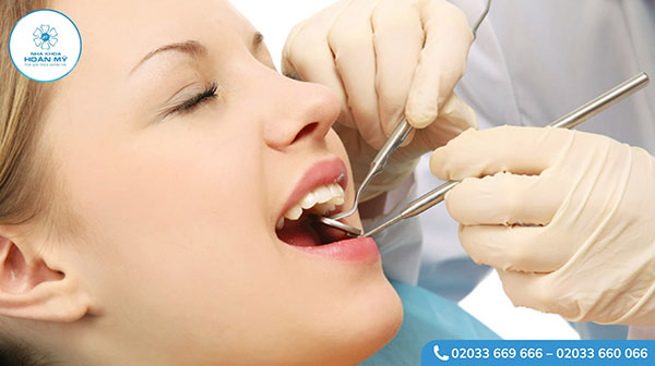 Quy trình trám răng cửa tại nha khoa